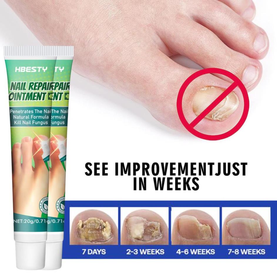 sg-11134201-7rbm0-lnibxhj1qjewe8