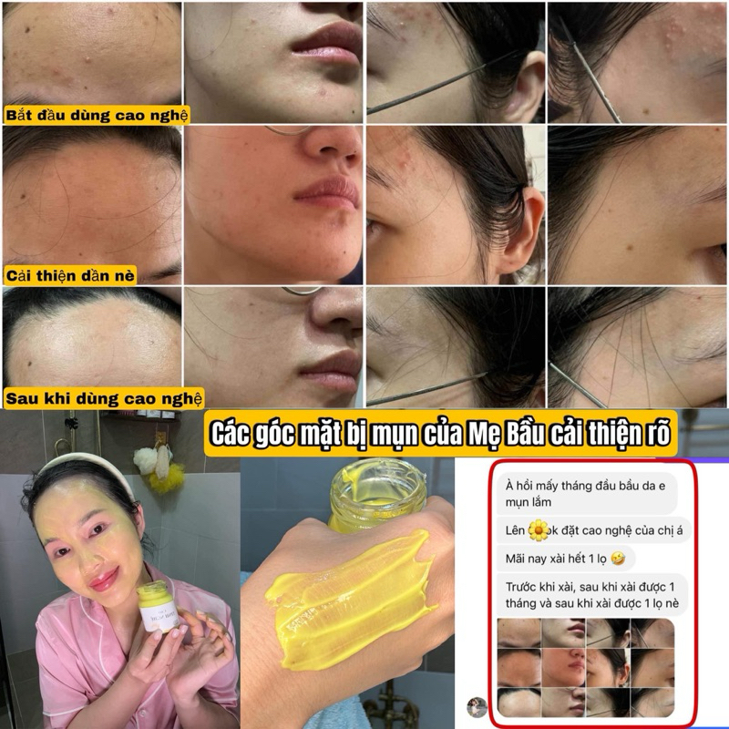 vn-11134207-7r98o-lzumckclma19c5