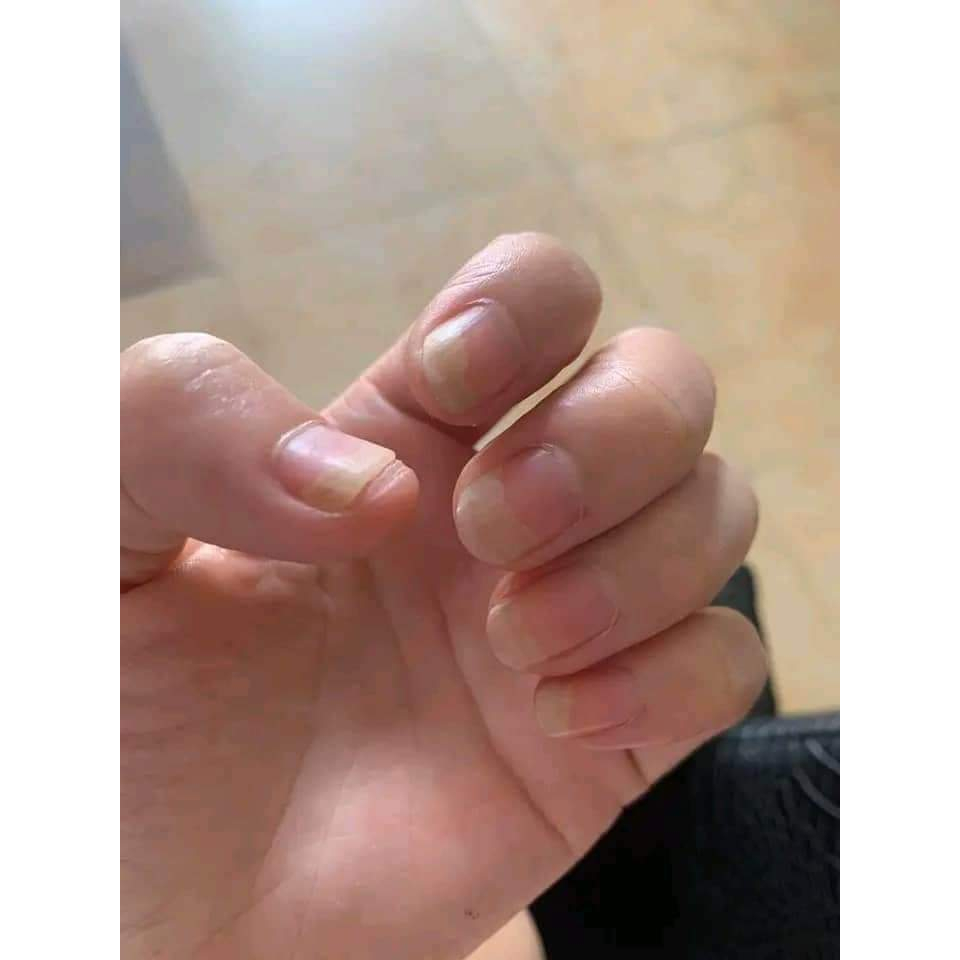 vn-11134207-7r98o-lkx8qnaugkilf5