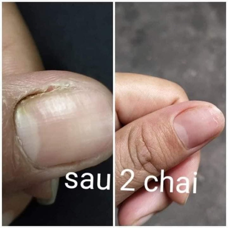 vn-11134207-7r98o-lkx8qnbofcnx70